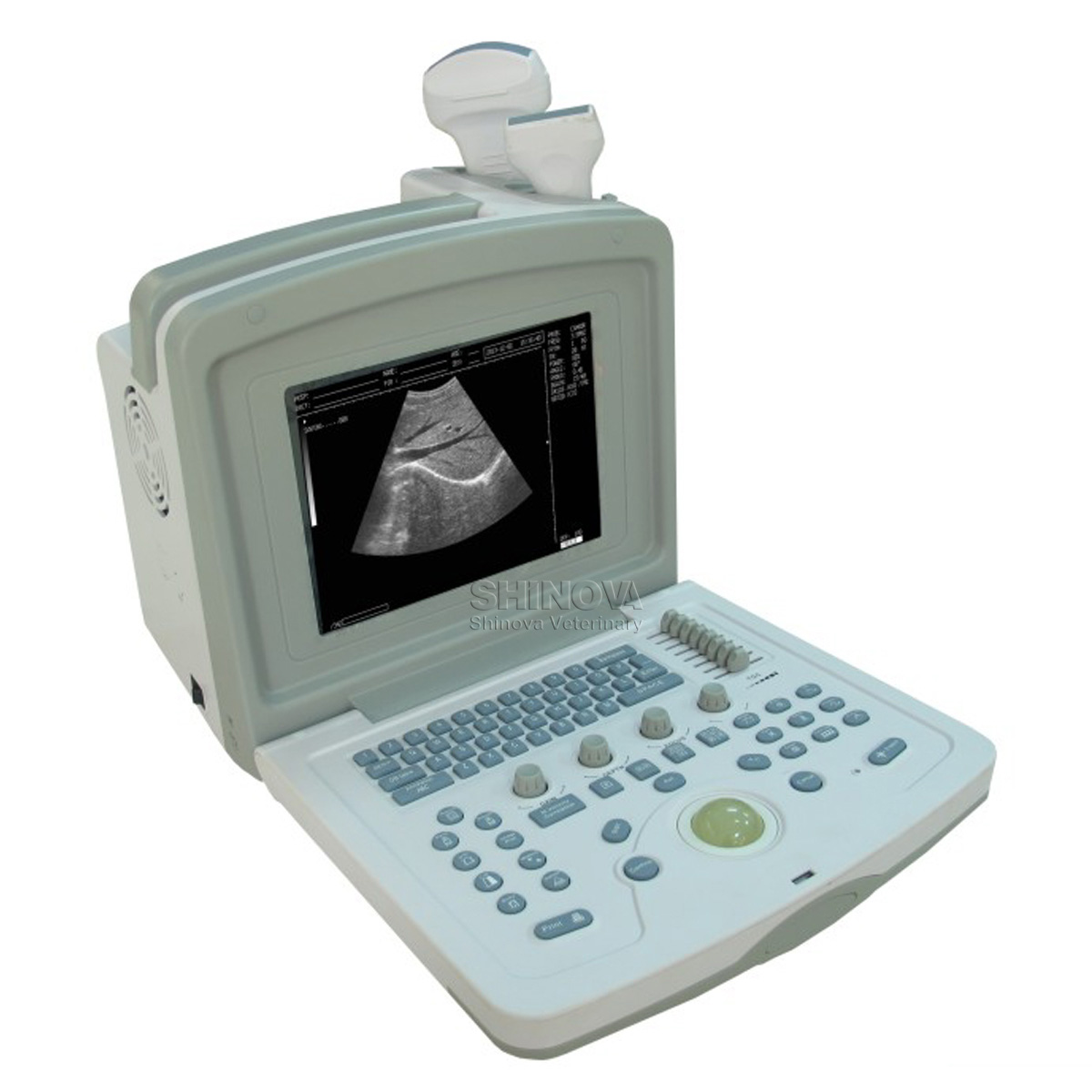 Portable Ultrasound Machine For Home Use Homemade Ftempo